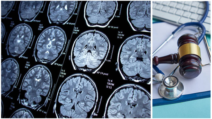 Identifying and Handling the Mild TBI Case
