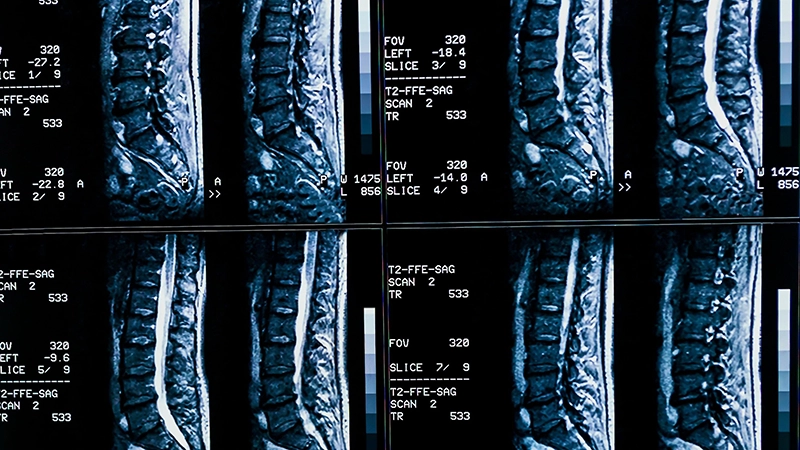 Occupational Medicine in the Courtroom: Navigating Medical and Legal Issues