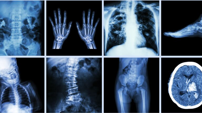 High-Stakes Orthopedic Injury Claims: IME Strategy, Healthcare Liability, and Exposure Control (2026 Edition)